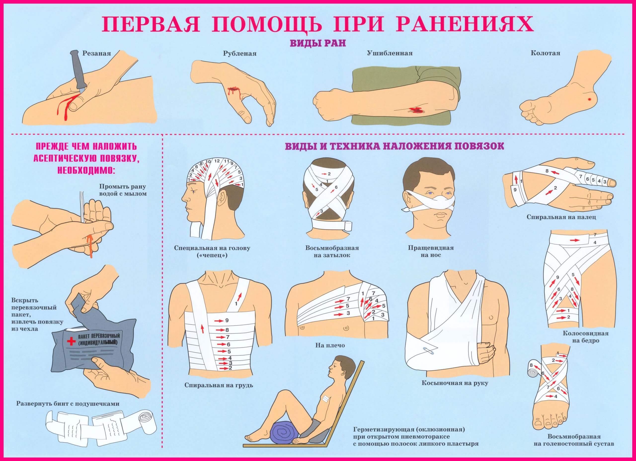 Медицинская подготовка. Оказание первой медицинской помощи при осколочных ранениях. Первый этап оказания первой помощи при ранениях. Порядок оказания ПП при ранении. Оказание первой помощи при ранениях и кровотечениях.